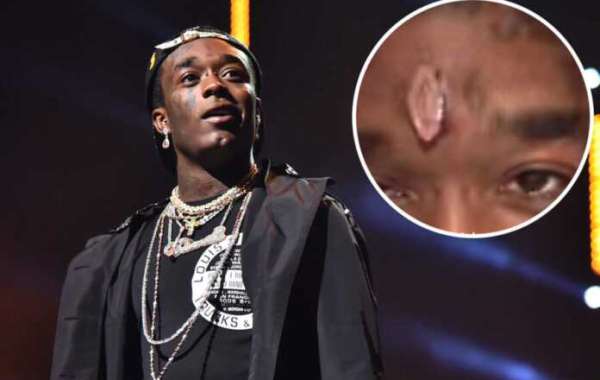Fans Have Ripped Out Lil Uzi Vert Diamonds Out Of His Forehead