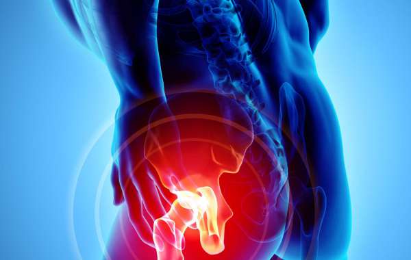Hip pain : Causes, Symptoms And Treatment - PillsPalace