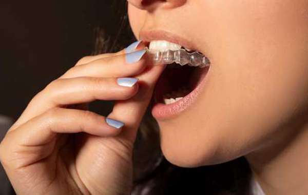 Treatment Cost of Invisalign in Texas