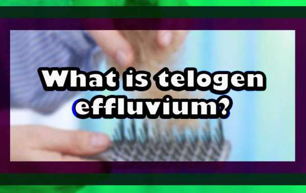 What is telogen effluvium?
