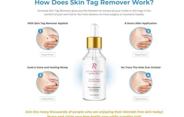 5 Top Risks Of Owning Amarose Skin Tag Remover Reviews