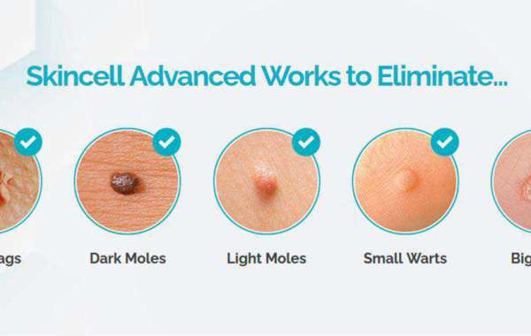 5 Outrageous Ideas For Your Skincell Advanced Reviews!