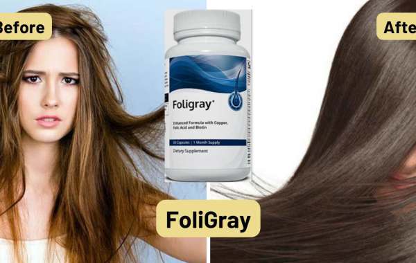 FoliGray Promote Strong, Thick And Healthy Hair. Contains High-Quality Ingredients! Alerts 2022 !
