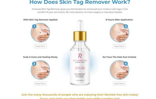 The Trending Stuff About Amarose Skin Tag Remover!